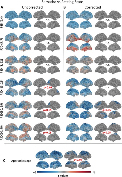 Mappe di attività cerebrale che mostrano l'aumento della complessità durante le due pratiche meditative rispetto al riposo. Le aree colorate indicano le regioni in cui la complessità del segnale aumenta in modo statisticamente significativo. Fonte: Pascarella et al., Neuroscience of Consciousness (2025). DOI: 10.1093/nc/niaf047. Riprodotto sotto licenza CC BY 4.0.